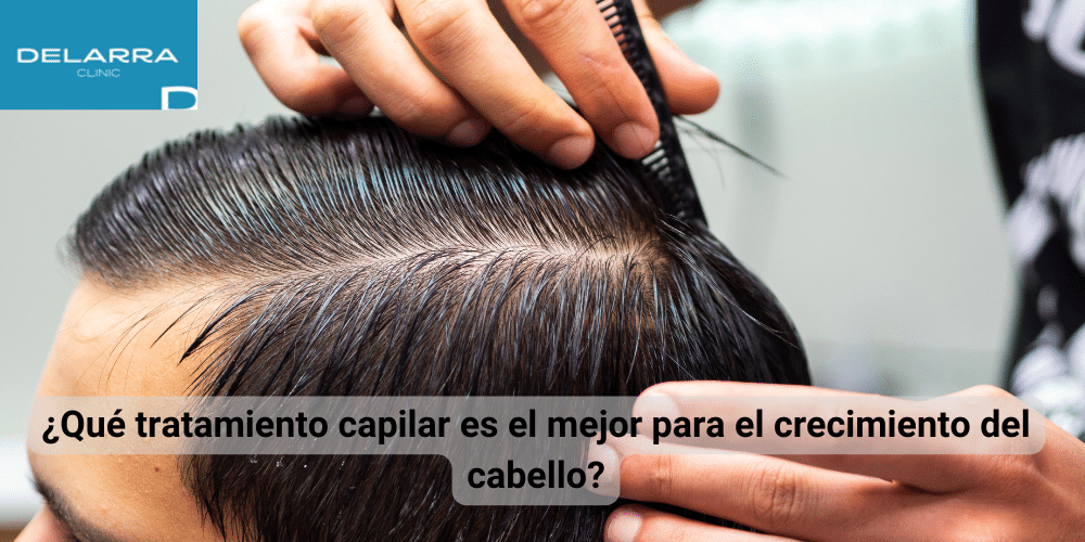 ¿Qué tratamiento capilar es el mejor para el crecimiento del cabello?