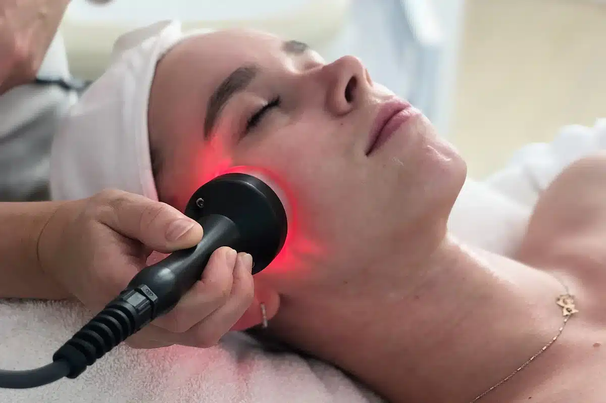 Radiofrecuencia facial: ¿Qué es y cuáles son sus beneficios?